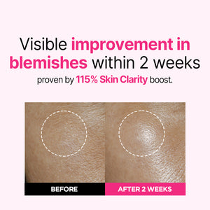 Blemish Care Up Serum Triple Set